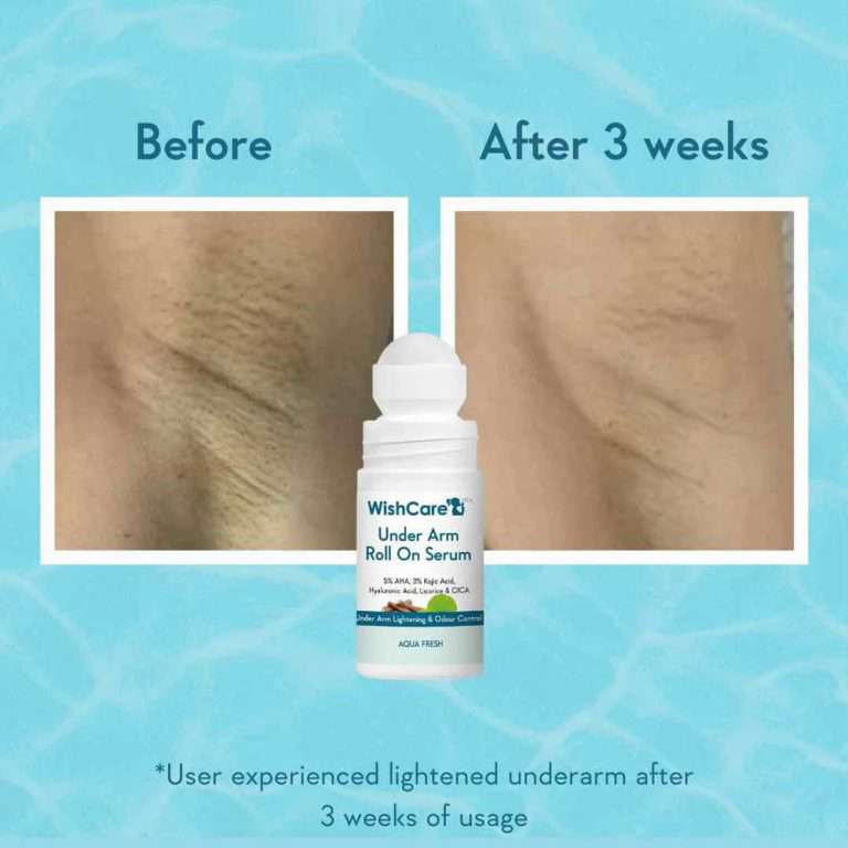 WishCare Under Arm Roll On Serum – 50ml