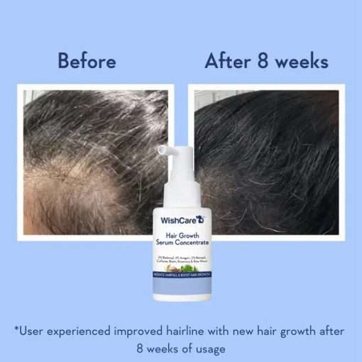 WishCare Hair Growth Serum Concentrate – 30ml